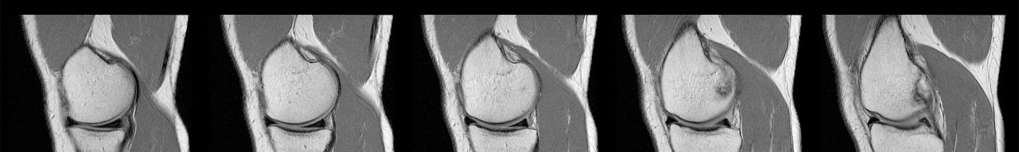 West Central Orthopedics | Greene County